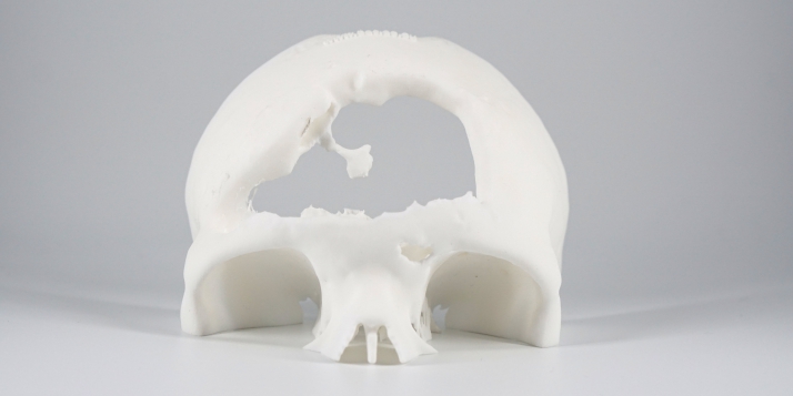 MyBone - © Cerhum MyBone - © Cerhum