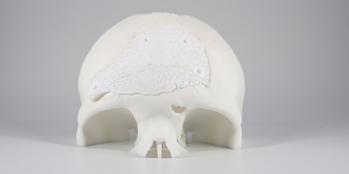 MyBone - © Cerhum MyBone - © Cerhum