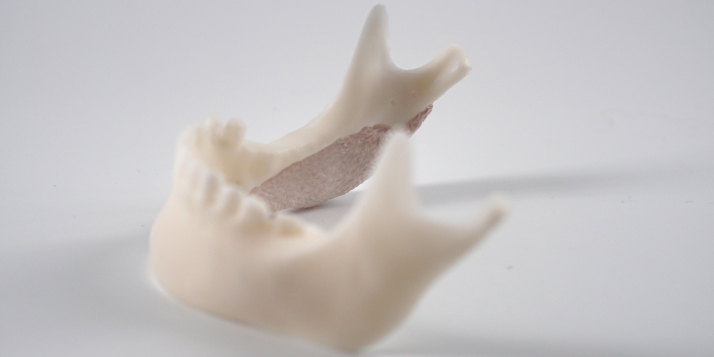 MyBone - © Cerhum MyBone - © Cerhum